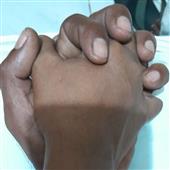 5 t