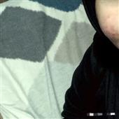 Apol