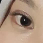 Tuyể
